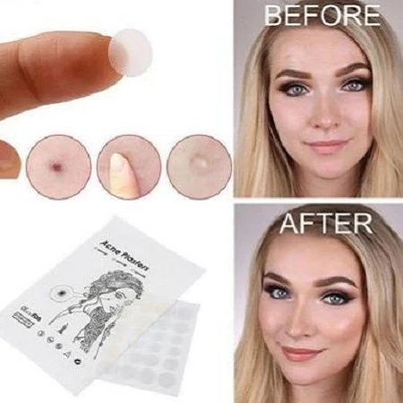Product Feature-1 Product Feature-1